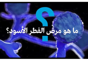 ما هو الفطر الأسود؟ هل هو معد؟