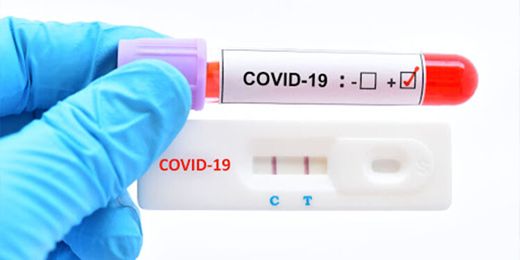 نقابة الصيدليات الخاصة ترفض التقيّد بتسعيرة وزارة الصحة لإجراء التحاليل السريعة 20 دينارا